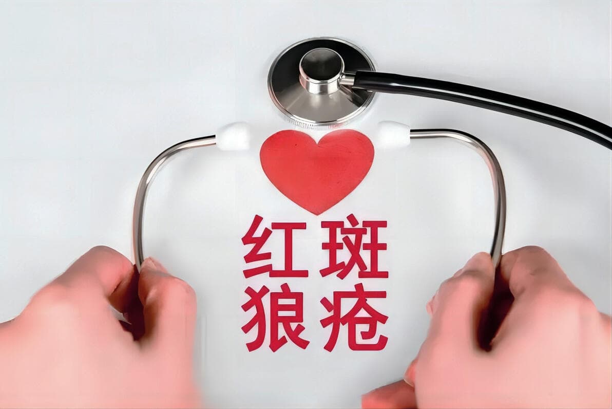 红斑狼疮患者与益生菌的潜在联系