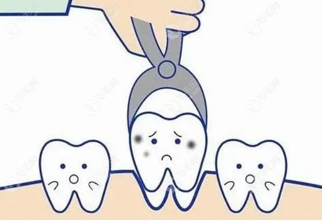 种牙填骨粉过程图解：5张图带您了解种植牙骨粉的作用和功效
