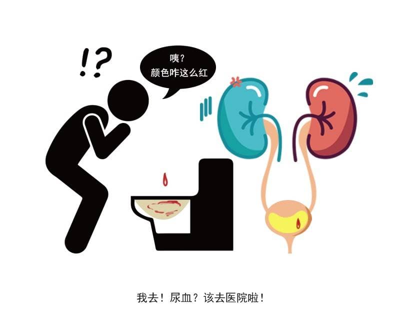肾癌有预警，身体这“三联症”提示肾脏病变