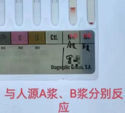 血型之谜：探秘 B(A) 血型的奥秘