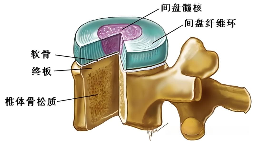 腰痛：椎体终板炎的解剖、分型及MRI表现