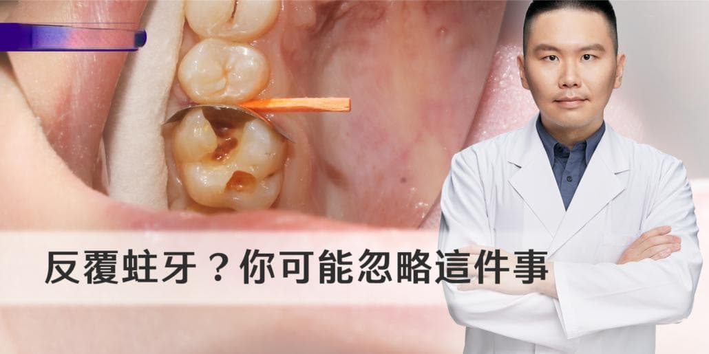 什么是反复蛀牙？原来治疗蛀牙需要注意这些事情
