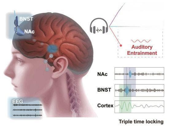 音乐疗法缓解抑郁症有奇效 我国科学家探索新型音乐治疗工具与应用