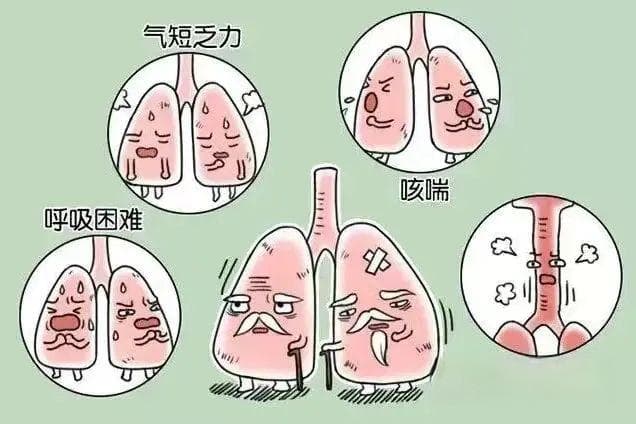 喘振对航空发动机来说是什么“病”？