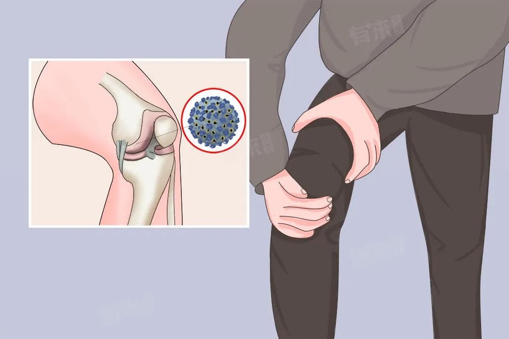 关节痛怎么缓解