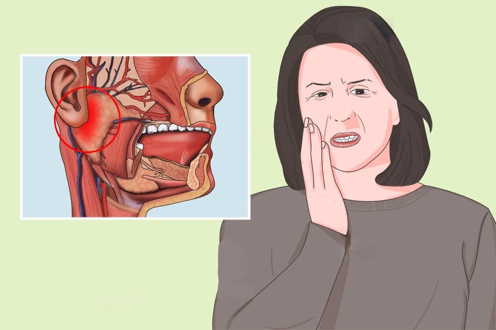 腮腺炎要注意哪些事项