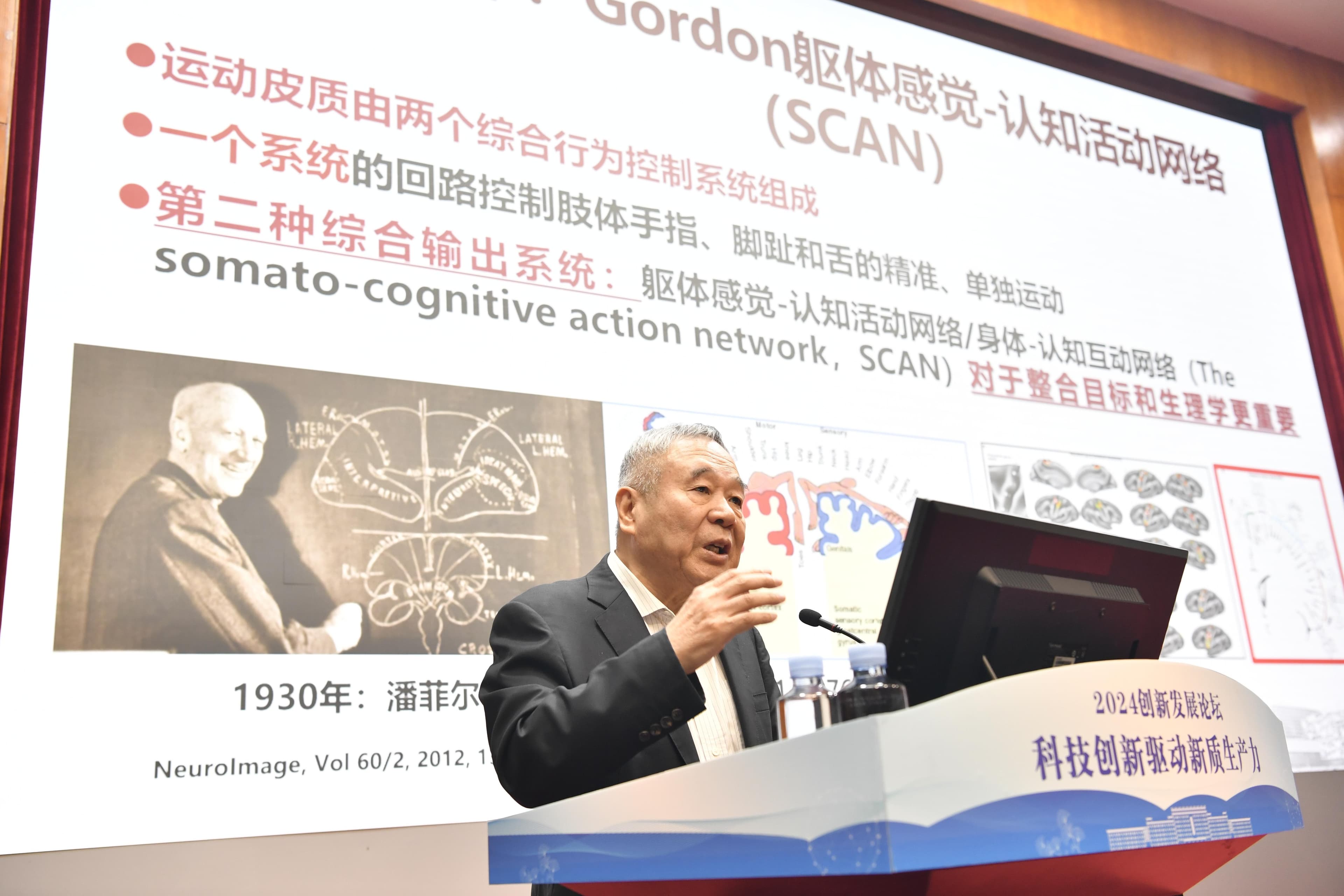 脑机接口研究，似一场漫长的“马拉松”