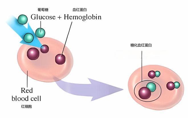 年终体检，@糖友们：别忘了这3项筛查