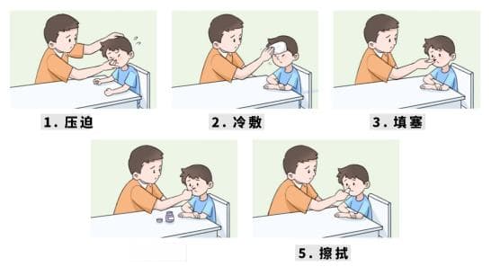 流鼻血到底如何处理：科学详实的急救指南