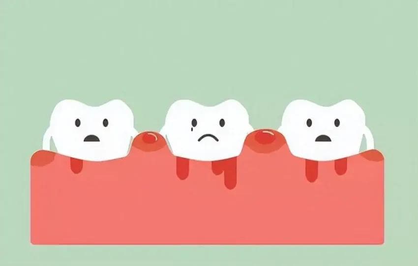 牙龈肿痛出血怎么办？教你7个有效的预防方法！守护口腔健康