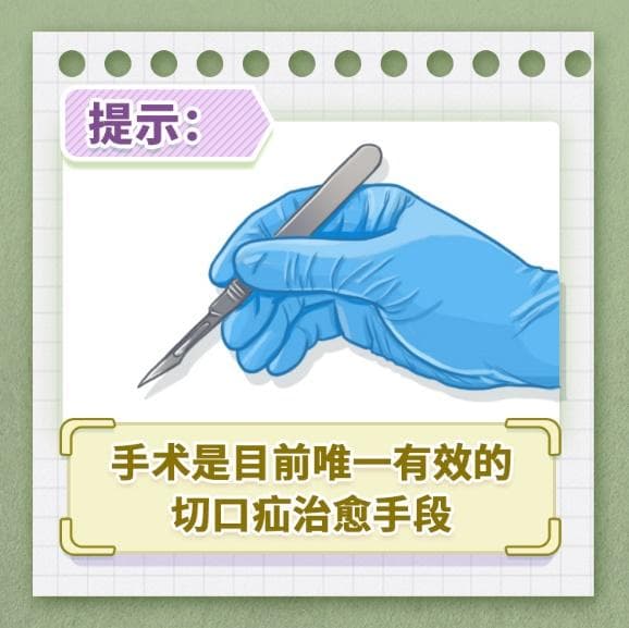 手术切口的隐患——切口疝的防治知识