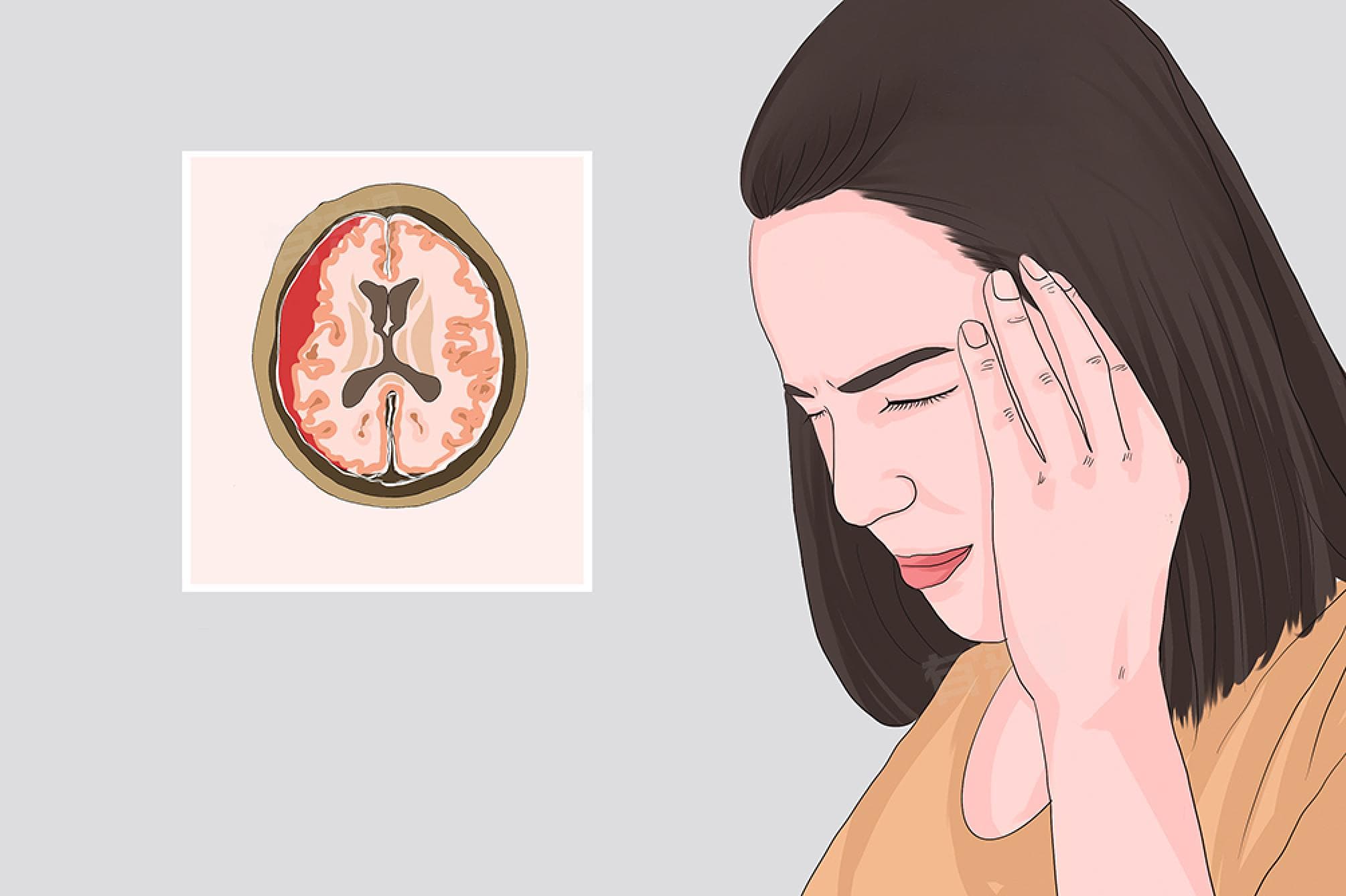 硬膜下血肿能恢复到正常人吗
