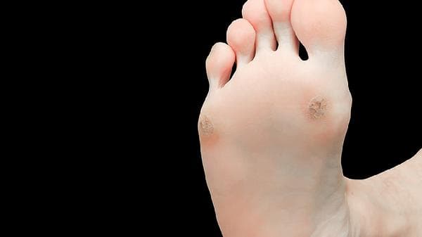 手脚麻木是什么病？多种病因及应对方法详解
