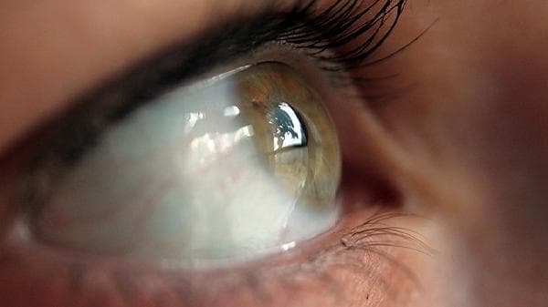 修复眼角膜的眼药水：类型、使用方法与注意事项