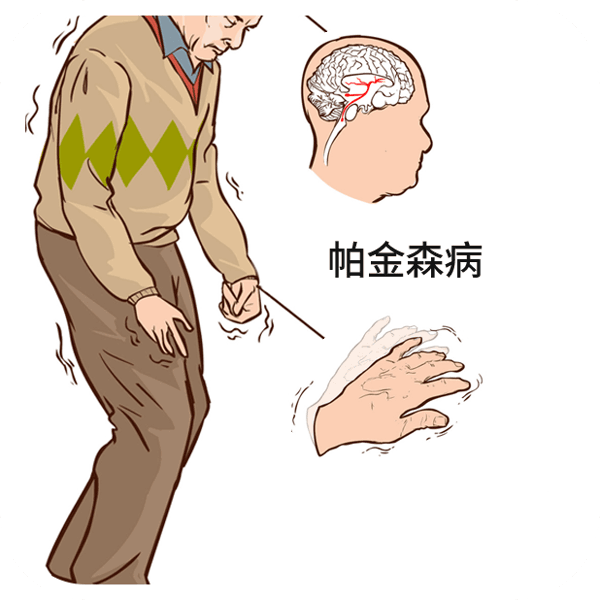 左半身麻木是什么原因造成的