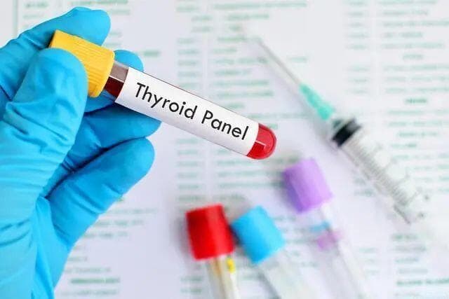 一文读懂这些甲状腺功能检查指标，附甲状腺功能检查前注意事项
