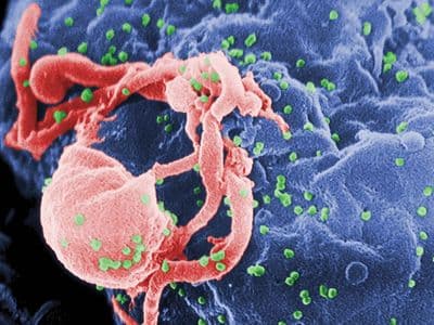艾滋病（AIDS）：定义、历史与全球分布