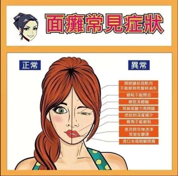 面瘫防治指南：症状识别、治疗方案与日常护理全攻略