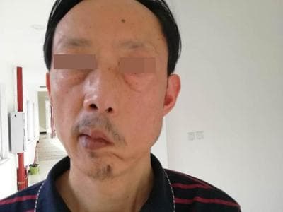 人的脸不对称正常吗
