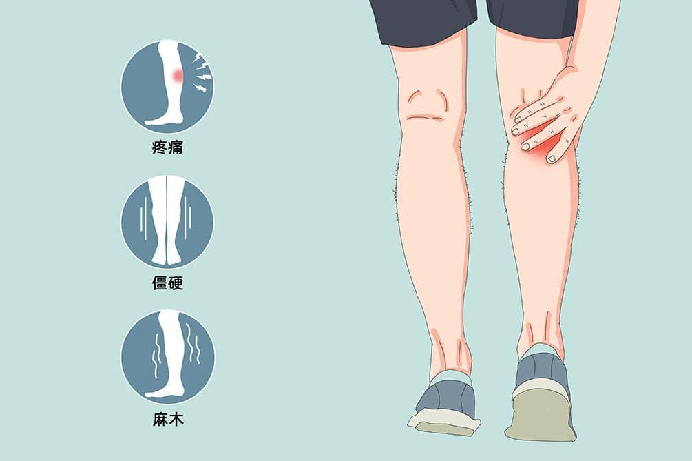 腿抽筋了怎么办快速缓解