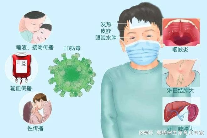人体的「潜伏者」巨细胞病毒，究竟是什么病毒？