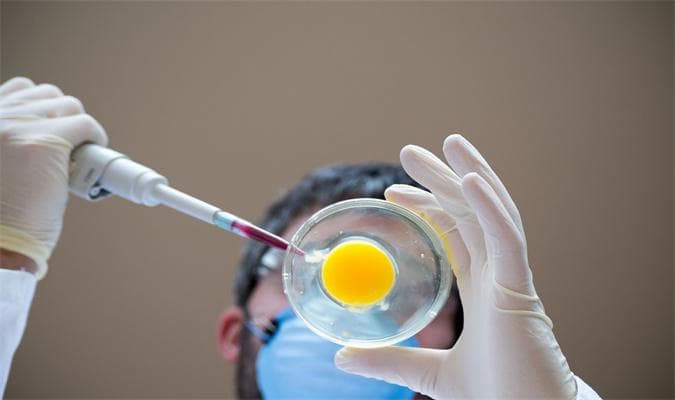 备孕免疫检查包括那些项目和内容?检查费用多少钱