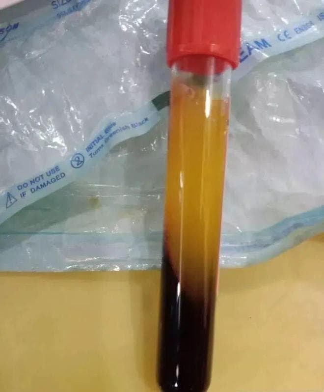PRF和CGF的区别到底是什么？有什么用途？