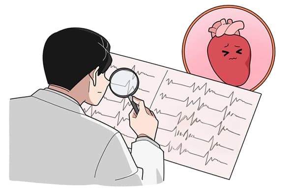 哪些人需要做心电图？