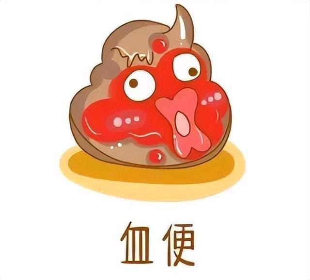 便血，该挂什么科呢？——教你快速分辨病因和挂科攻略