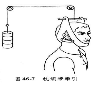 骨科牵引的护理要点及注意事项（附牵引的分类）