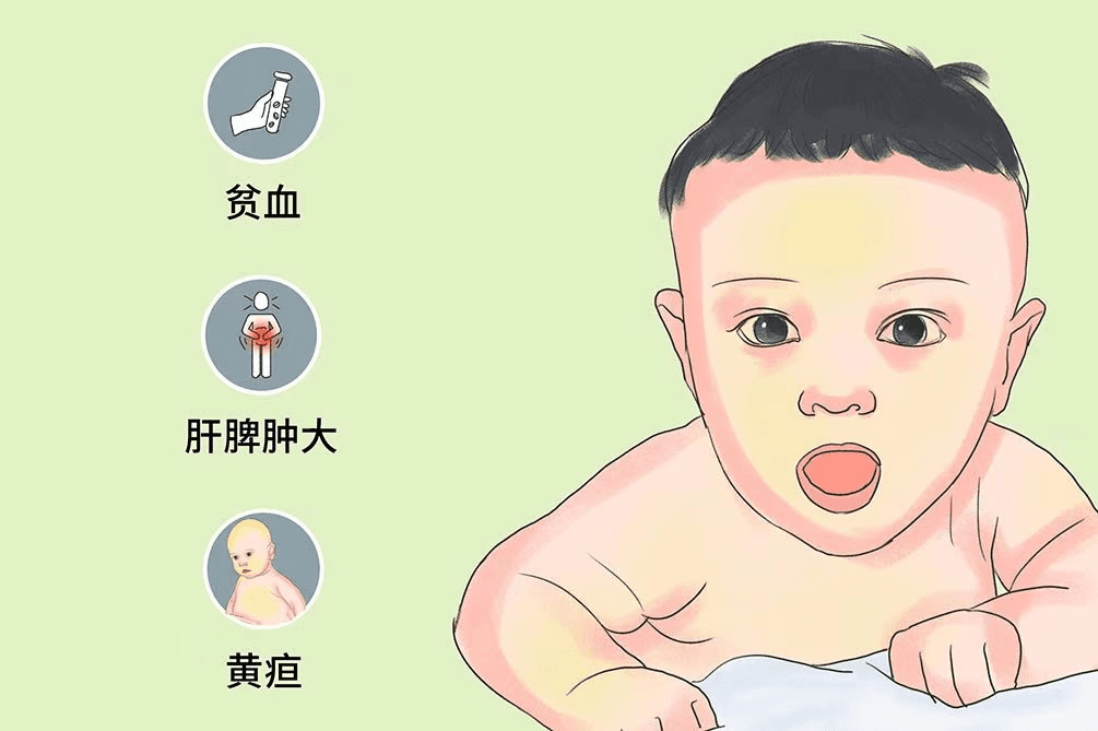 新生儿高胆红素血症：从成因到应对全解析