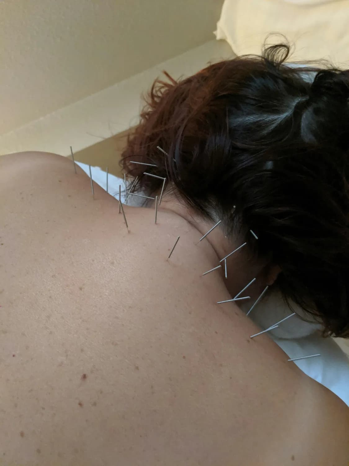 中医按摩治后颈痛，这些穴位你get了吗？