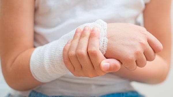 骨折处理全攻略：从急救到康复的完整指南