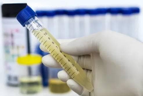 5分钟教你看懂尿常规化验单，并不难！