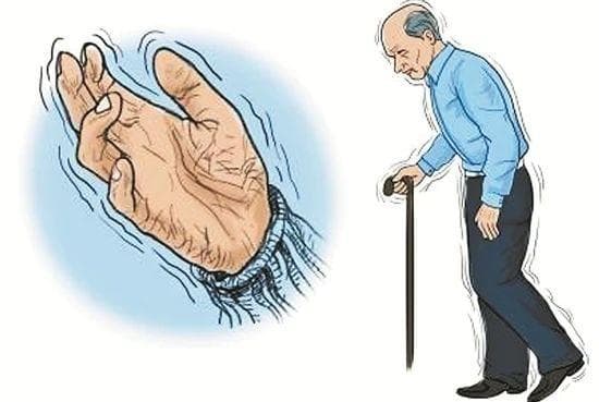 帕金森病初期的心理挑战与应对之道