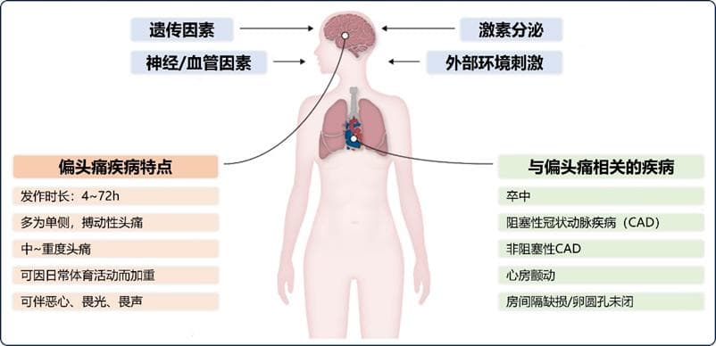 为什么『偏头痛』会增加心血管疾病？