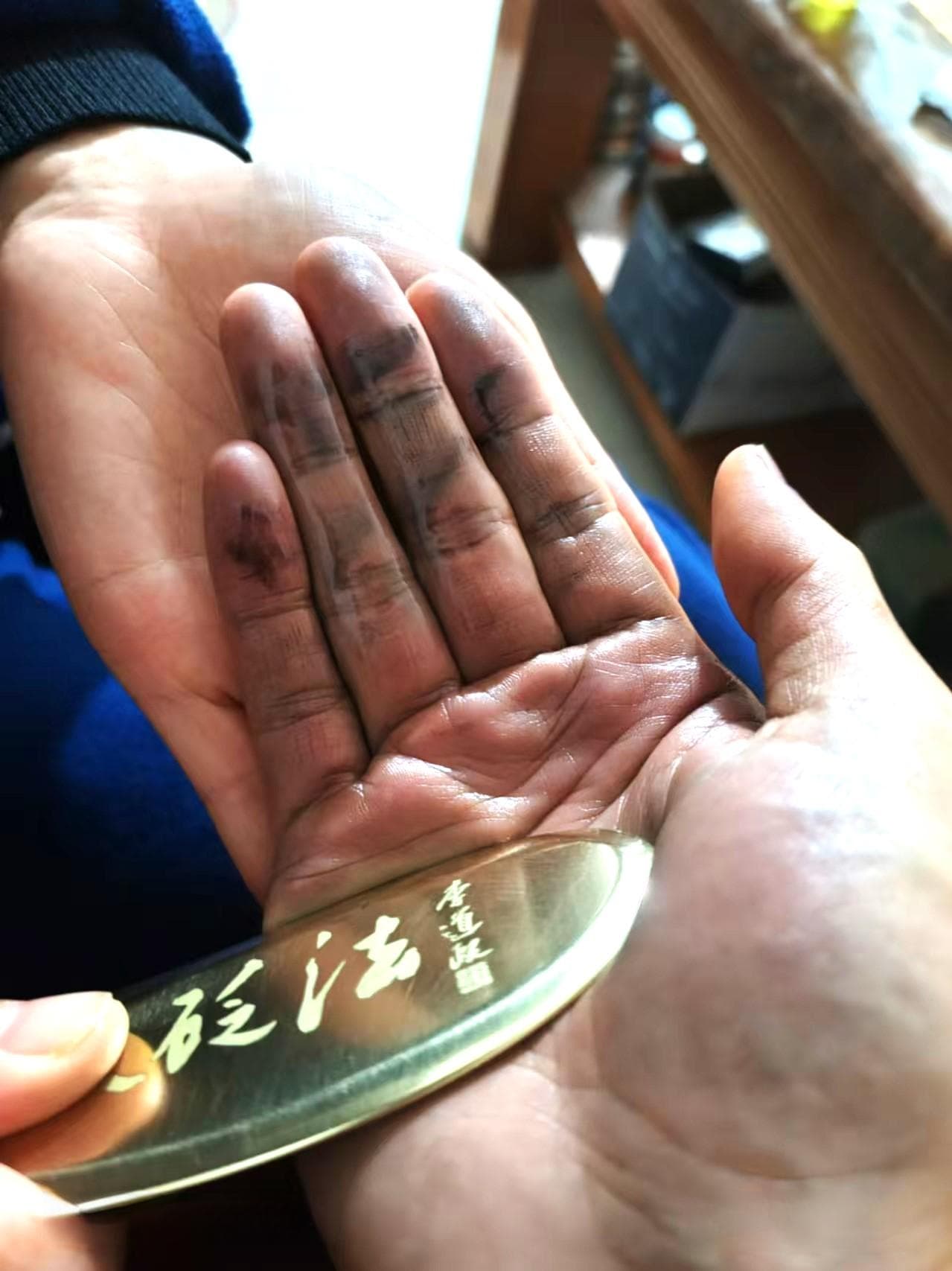 刮痧：从传统智慧到现代医学的解读