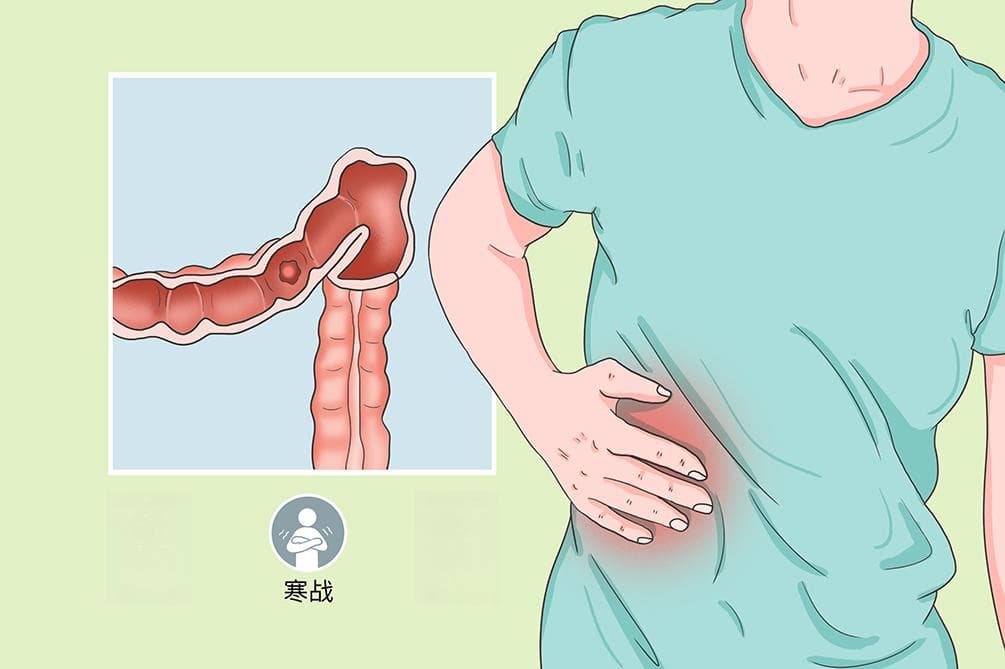 右腹部疼痛的病因、症状与治疗