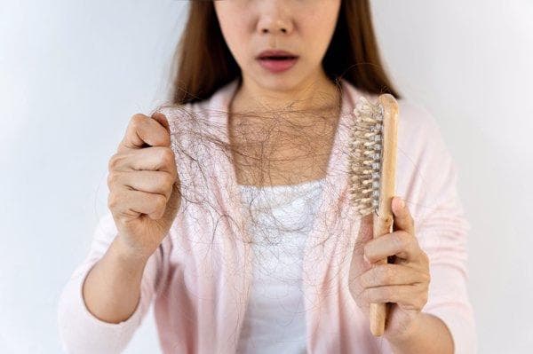 男性脱发与雄性激素的关系：从发病机制到治疗方案