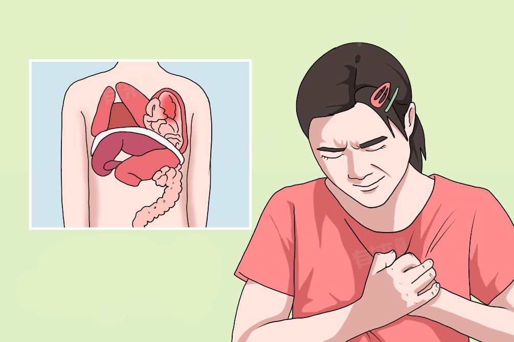 膈疝表现的症状