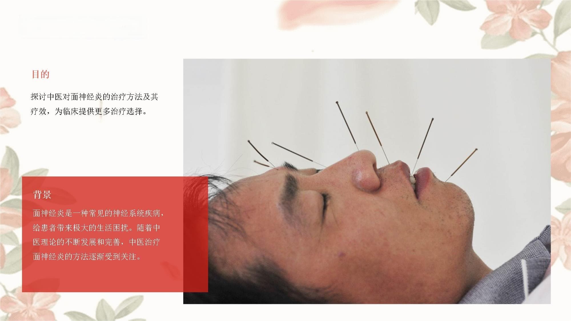 面神经炎中医治疗
