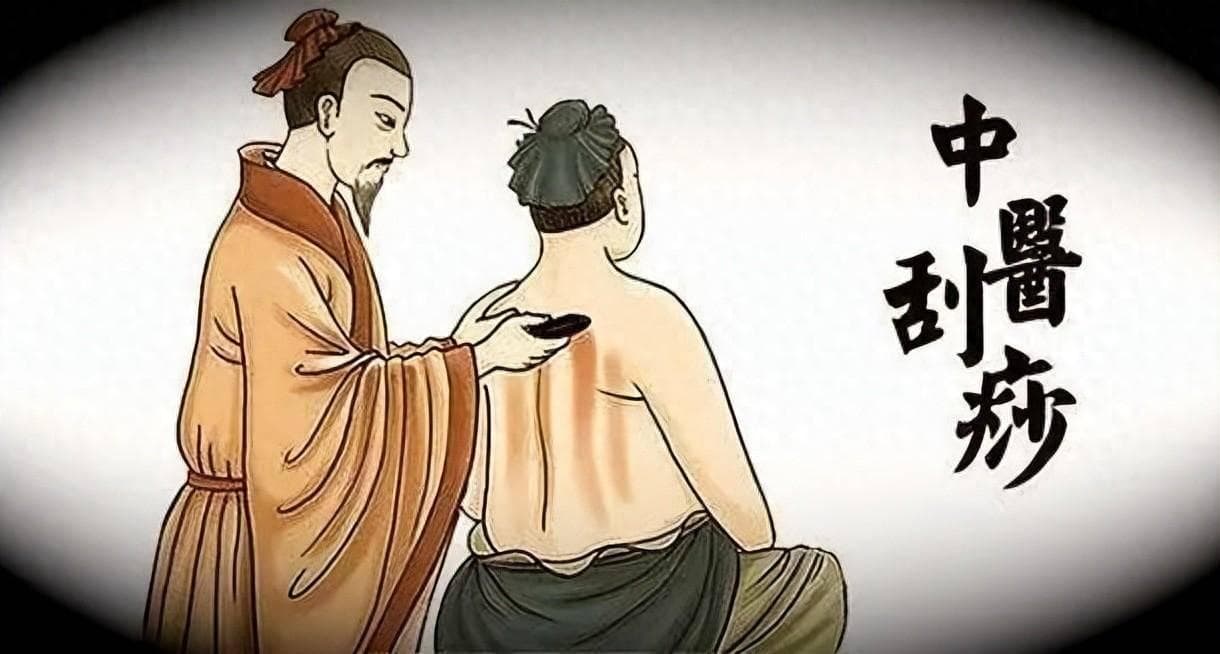 一试便知！刮痧：古老疗法的现代魅力，你不可不知！