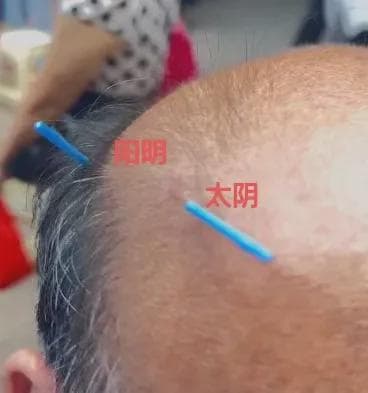 秋凉了，腰痛不用慌，中医有良方