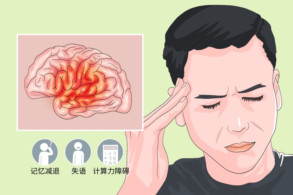 认知障碍的五大预警信号，这些症状要当心