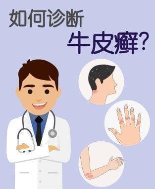 牛皮癣：成因、症状、诊断与治疗全解析