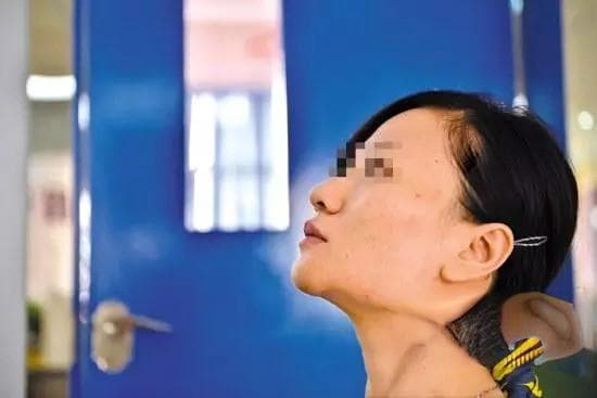 整形美容安全警示：生长因子注射风险全解析