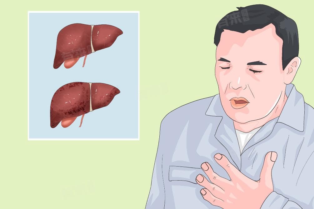 肝病的八大征兆