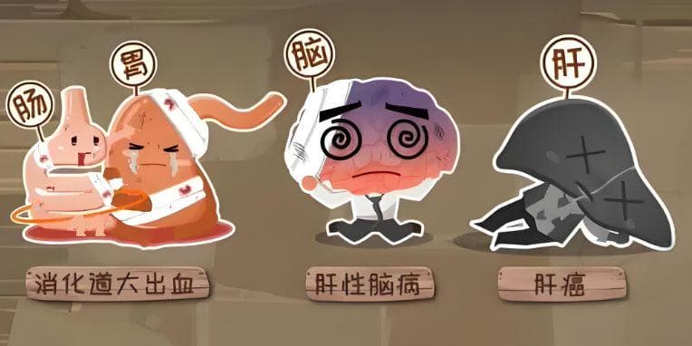 3个指标是肝硬化恶化的“信号灯”，提示病情进展，一定要警惕