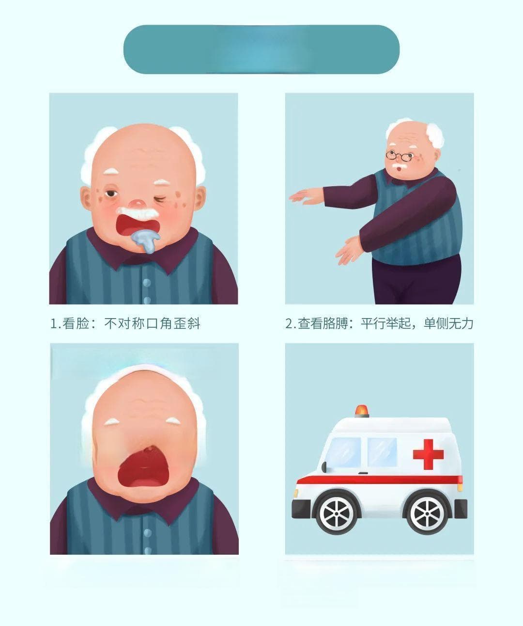 脑卒中预警：频繁咬舌头不可忽视