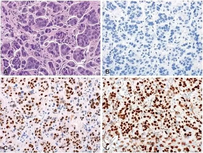 超详细解读——免疫组化实验原理、操作步骤和注意事项，新手快速入门必看！
